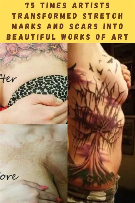 75 Times Artists Transformed Stretch Marks And Scars Into Beautiful