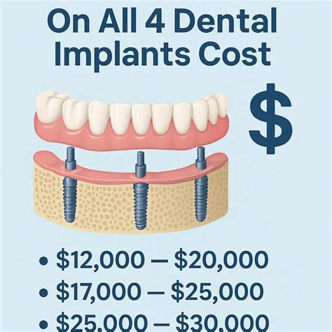 All on 4 Dental Implants Cost in Toronto Explored