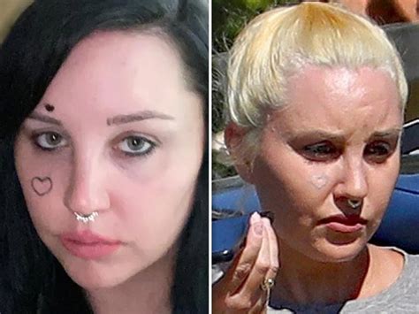 Amanda Bynes Is Removing Her Face Tattoo Shows Her Progress In New