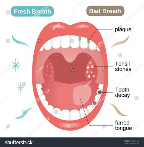 Bad Breath Before and After: Surprising Transformations Unveiled