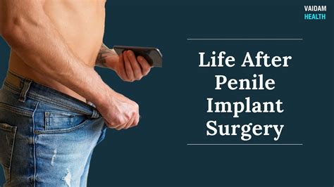 Before After Penile Surgery Transformations Revealed