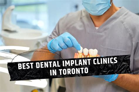 Best dental clinic cost in Toronto revealed