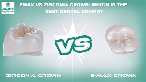 Best Dental Crown Cost in Toronto Uncovered