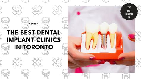 Top Choices for Best Dental Implants in Toronto