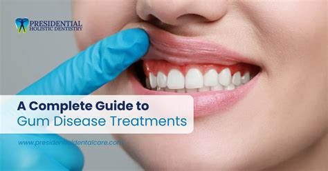 Top UK Gum Disease Treatment Guide 2023