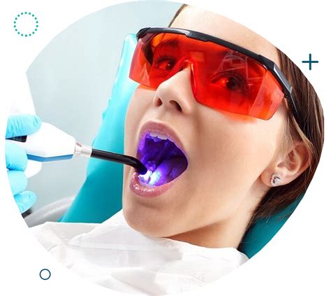 Best Laser Dentistry in London Revealed