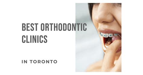 Top Choices for Best Orthodontic Treatment in Toronto