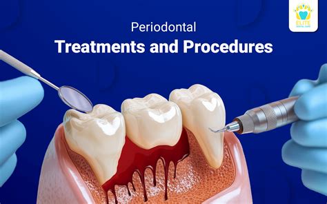 Best Periodontal Treatment in Dubai: Top Experts