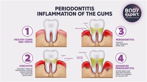 Best Periodontal Treatment UK: Top Dentist Options