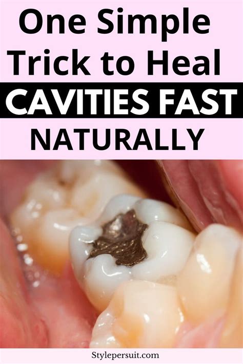 Natural Remedies to Beat Cavities and Protect Your Smile