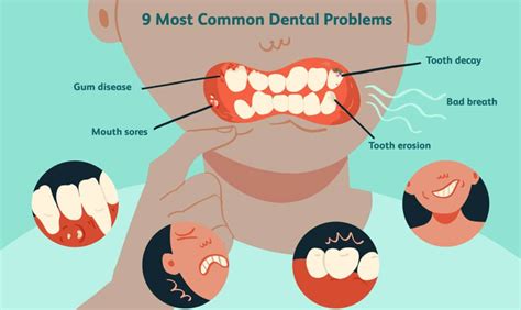 Unlocking the Secrets: Common Problems with Dental Hygiene You Can't Ignore