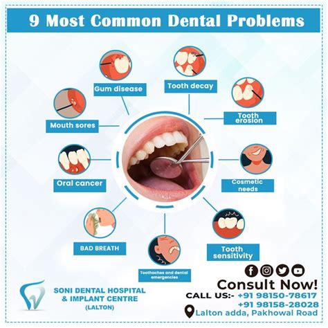 Common Problems with Dental Treatment: Surprising Challenges You Didn't Know About
