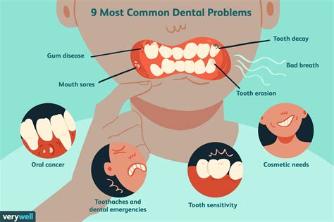 Unveiling Common Problems with Gum Disease