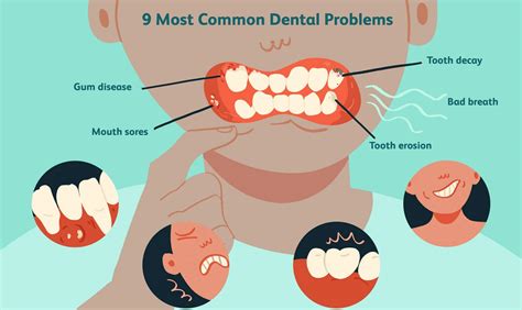 Common Problems with Tooth Protection You Never Knew About