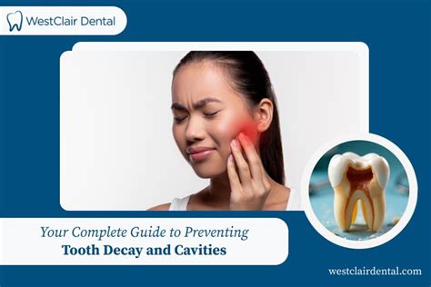 Ultimate Complete Guide to Tooth Decay: Uncover the Secrets to Prevention and Treatment