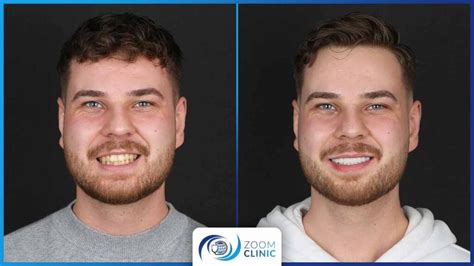 Real Cosmetic Dentistry Results: Unveil Transformation!