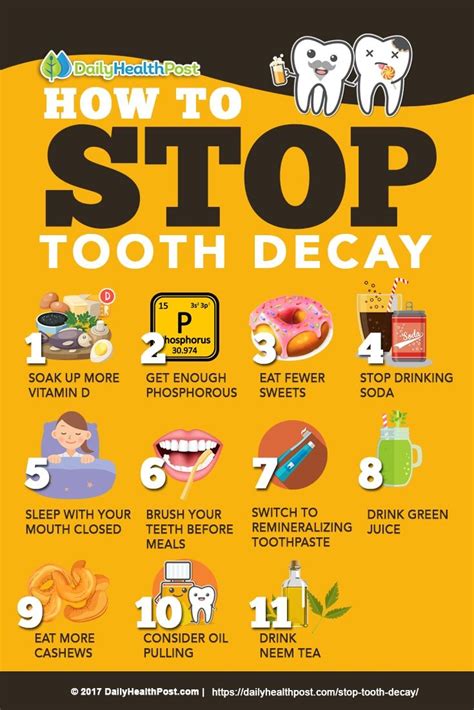 Daily Habits for Tooth Decay Prevention That Work