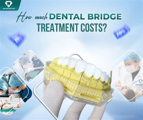 Best Dental Bridge Treatment Clinic Revealed