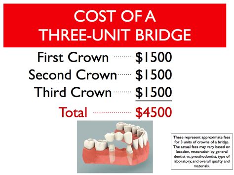 Dental Bridge Treatment Cost: Surprising Insights!