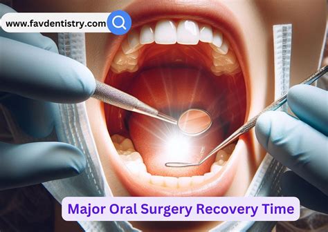Unlock Secrets to Faster Dental Surgery Recovery Time: Your Comprehensive Guide