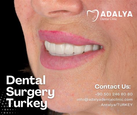 Top Dental Surgery Reviews Uncovered!