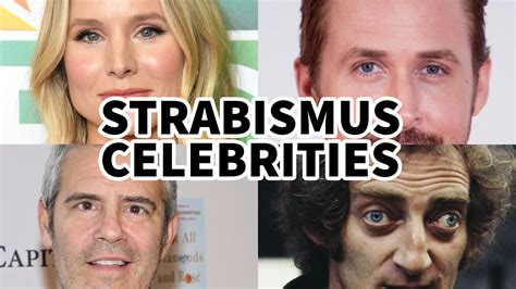 Famous Person with Strabismus: Surprising Star!
