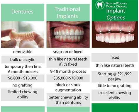 Full Mouth Dental Implants Cost Breakdown: Top Insights
