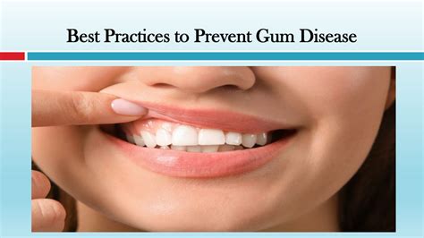 Best Practices for Preventing Gum Disease Now!