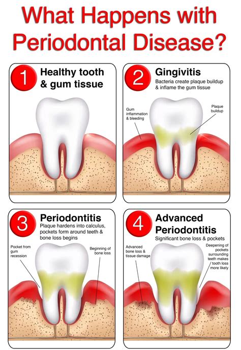 Uncovering the Top Gum Disease Causes and Prevention Tips