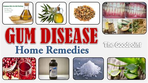 Natural Cures for Gum Disease Home Remedies That Really Work