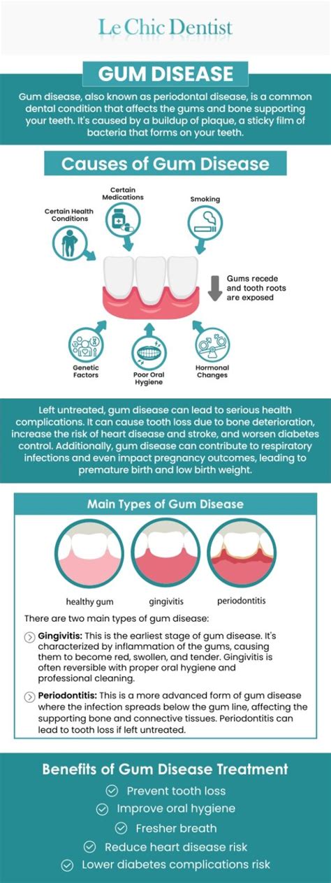 Best Gum Disease Treatment Los Angeles
