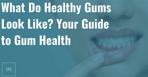 Ultimate Gum Health Guide for Optimal Wellness