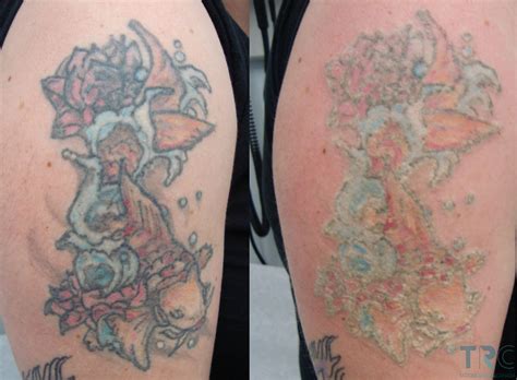 How To Prevent Tattoo Fading Over Time Tattoo Designs World