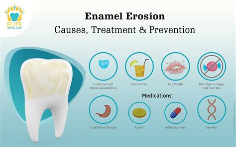 Ultimate Guide to How to Treat Enamel Care for Optimal Dental Health