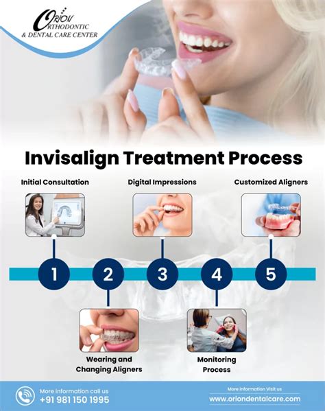 Get the Perfect Smile Unlock Your Best Self with Invisalign Treatment Consultation