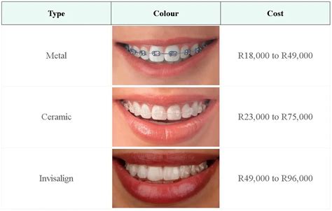 Unveiling Invisalign Treatment Cost in Australia: Get the Facts Now!