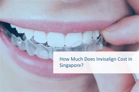 Unveiling Invisalign Treatment Cost in Singapore: What to Expect?