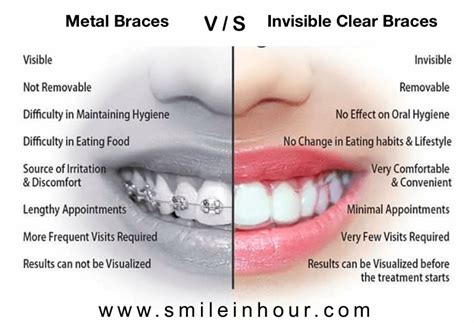 Invisible Braces Treatment Cost: Affordable Realignment