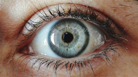 The Secret to Limbal Rings and Youthful Eyes Revealed