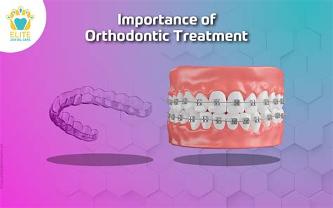 Emergency Orthodontic Treatment 24 Hour Service Available