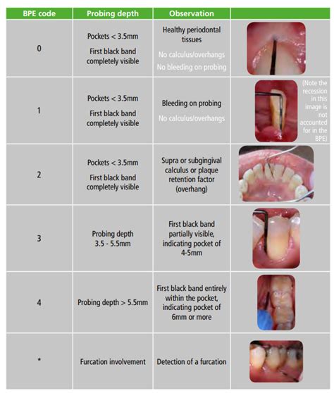 Periodontal Treatment Results Revealed: Transform Your Smile Today