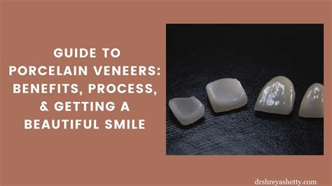 Top Porcelain Veneers Benefits You Need to Know