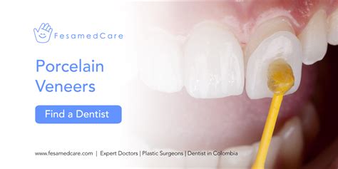 Unlock Your Best Smile: Discover Porcelain Veneers Consultation Today