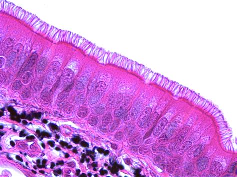 Discover the Mystery of Pseudostratified Ciliated Columnar Epithelium