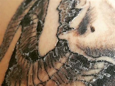 Tattoo Peeling 101 Why Your Newly Inked Skin Is Flaking Off