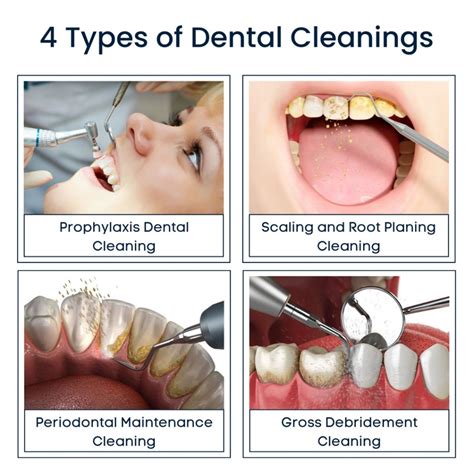Teeth Cleaning Explained: Simple Steps for a Brighter Smile