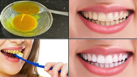 Discover Effective Teeth Cleaning Home Remedies Today