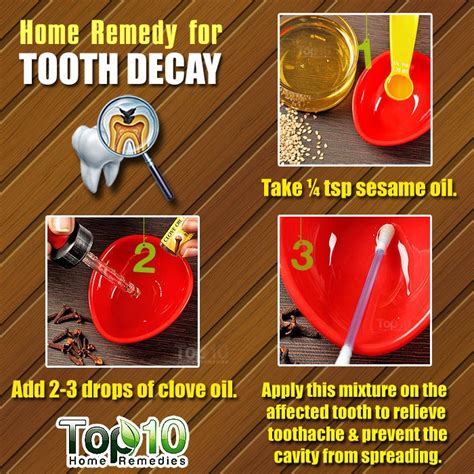 Best Tooth Decay Home Remedies You Must Try