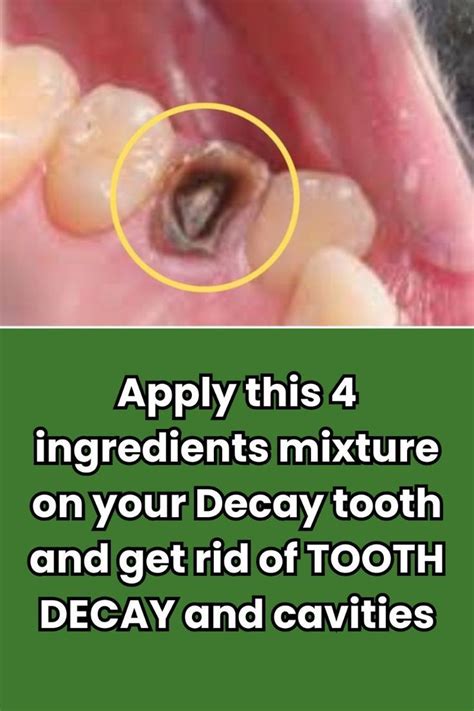 Natural Tooth Decay Cures: Effective Remedies