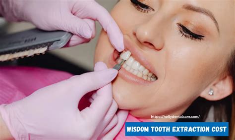 Unlocking Affordable Tooth Extraction Costs in London